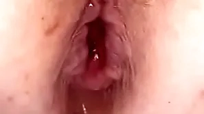 Anal bomb in my botheration