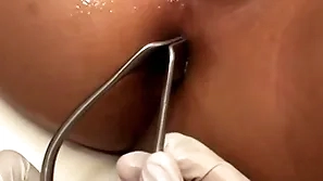 Asian patient penetrated wide anal hole by stud wide missionary