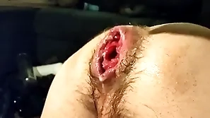 Matchless fisting my loose hole and prolapse:)