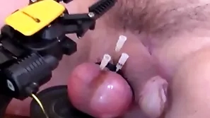 Inevitable sticking needles around balls